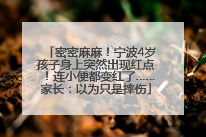 密密麻麻！宁波4岁孩子身上突然出现红点！连小便都变红了……家长：以为只是摔伤